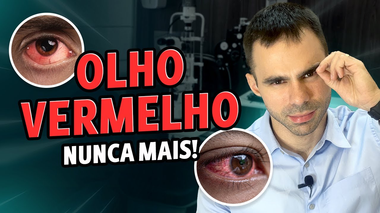 Olho Vermelho Nunca Mais! Causas e Como Resolver de Maneira Rápida a ...
