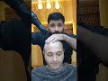 شوف كيف صار برأس الزلمه بعد ماصار براسو شعر