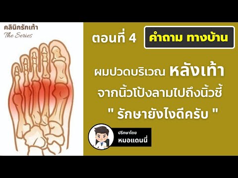 ปวดหลังเท้าตรงนิ้วโป้งไปถึงนิ้วชี้ ลามไปถึงกลางเท้า (ซีรีย์ รวมคำถามอาการปวดจากทางบ้าน ตอนที่ 4)