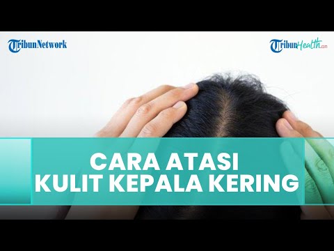 Video: 3 Cara Mencegah Kulit Kepala Kering