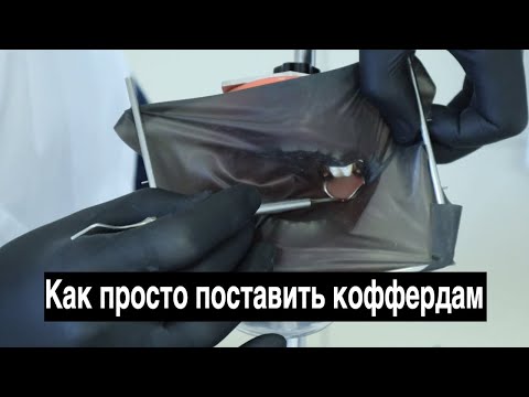 Самые простые способы поставить коффердам. Изоляция в стоматологии