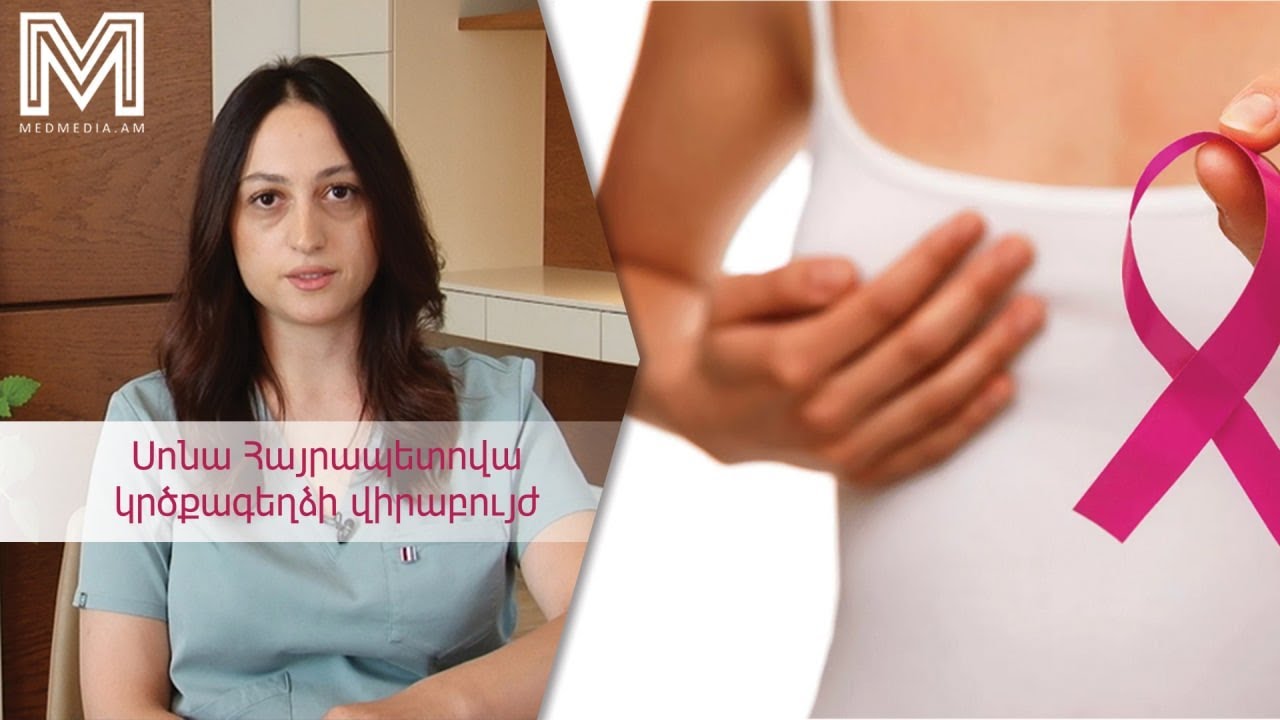 Երեք խորհուրդ բժշկից․կրծքագեղձի քաղցկեղ