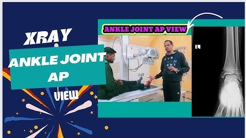 X RAY ANKLE JOINT AP VIEW #ankle #jointpain #xray #anterior #posterior #views #view
