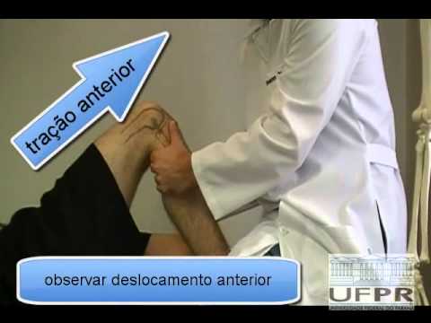 Teste da Gaveta anterior - Joelho - UFPR - YouTube