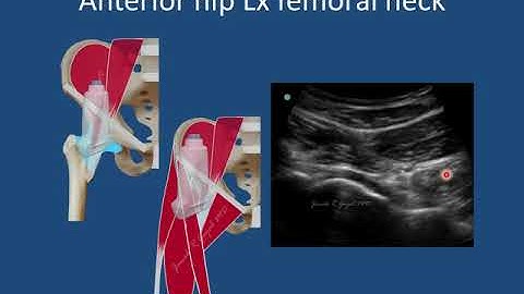 Hip joint scanning techniques