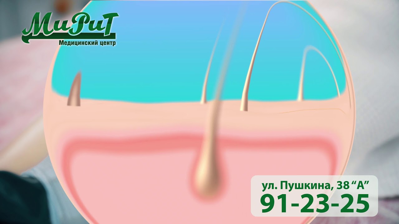 Мирри маз дур