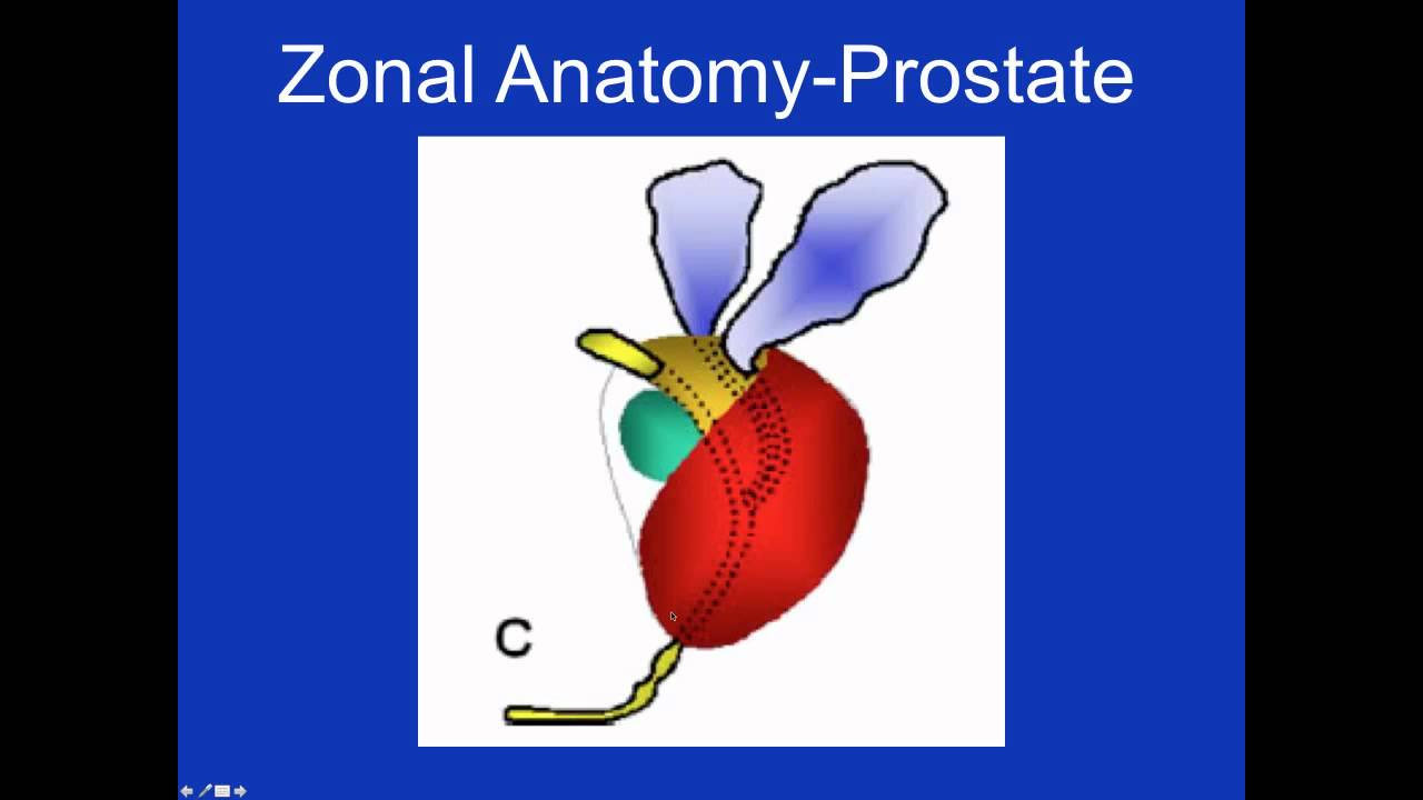 YT Prostate Zonal Anatomy.mp4 - YouTube
