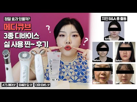 *메디큐브 3종 디바이스✔️N달⚠️사용해 본 찐 후기│<strong>ATS</strong> 에어샷 / 유쎄라 딥샷 / 더마 EMS샷│유쎄라 싸게 사는 법‼️