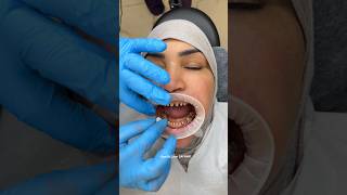 Gülüş Tasarımı Işlemi