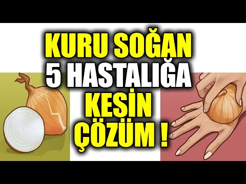 Kuru Soğan Bu Hastalığı Anında İyileştirir