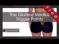 The Gluteus Medius Trigger Points and Low Back Pain