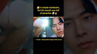 😱 A simple toothache…But his mouth was full of parasites 💀🔥#shorts