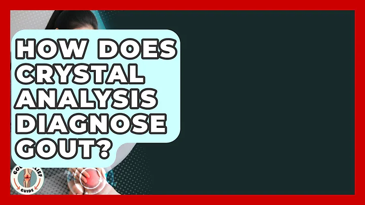 How Does Crystal Analysis Diagnose Gout? - Gout Relief Guide