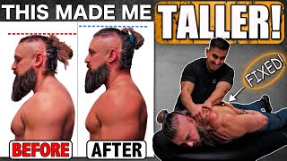 The WORST PAIN ❗️ Fixing Years Of Untreated BAD POSTURE Made Me Taller!! (Full Routine &amp; Results)