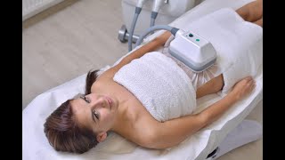 Cool Sculpting/Cryolipolisis at Home Experience and Review. Do it Yourself