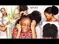 TRIED THE FAMOUS ALOE VERA HAIR TREATMENT ON MY DAUGHTERS DRY 4C HAIR. DOES IT WORK? HAIR DETANGLE!