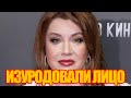 Вера Сотникова подала в суд на косметолога: “Мне изуродовали лицо!”