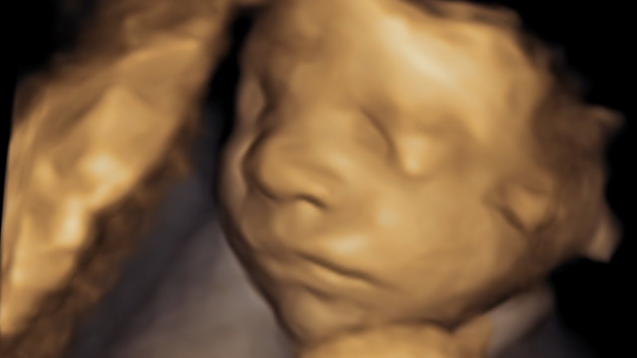 MEL & DAYLE PART 2 28 weeks 4D & HDLIVE baby scan - YouTube