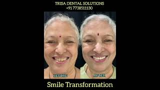 Smile Makeover in just 3 Days | Before After Transformation #short