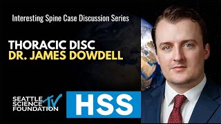 Thoracic Disc Herniation  James Dowdell, M.D.