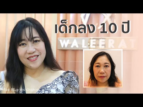 รีวิวลูกค้า Ruby No.5 + ยกกระชับ Lower Face Lift ที่ Waleerat Clinic