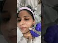 😍No filter real glow 💫 #pdrn #microneedling #glowup #drsmritinathani #skincare #weekend