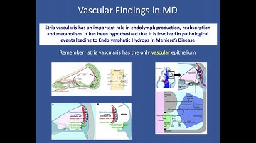 ISNVD Webinar 2: Meniere