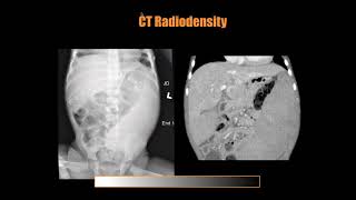 Pediatric Radiology is the Best Specialty, Dr. David Dansie