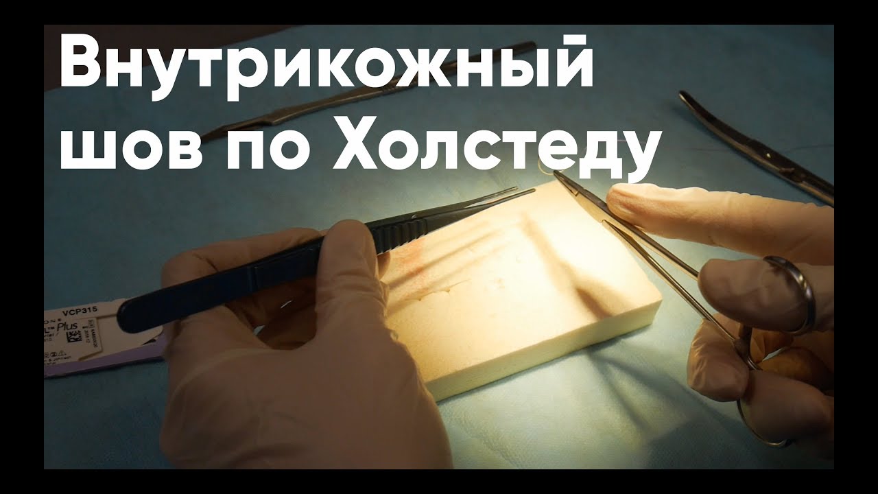 Внутрикожный шов по Холстеду (косметический шов) - YouTube