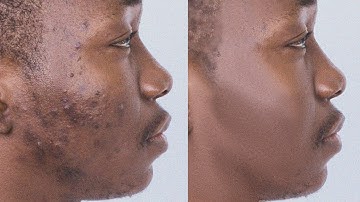 HighEnd Skin Retouching InDepth Tutorial Frequency Separation In Photoshop