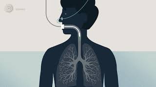 Bronchoscopy  examination of your airways (English version)