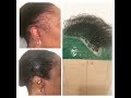 How to Make a Postiche to Cover Thinning Edges | by Amid Beauty