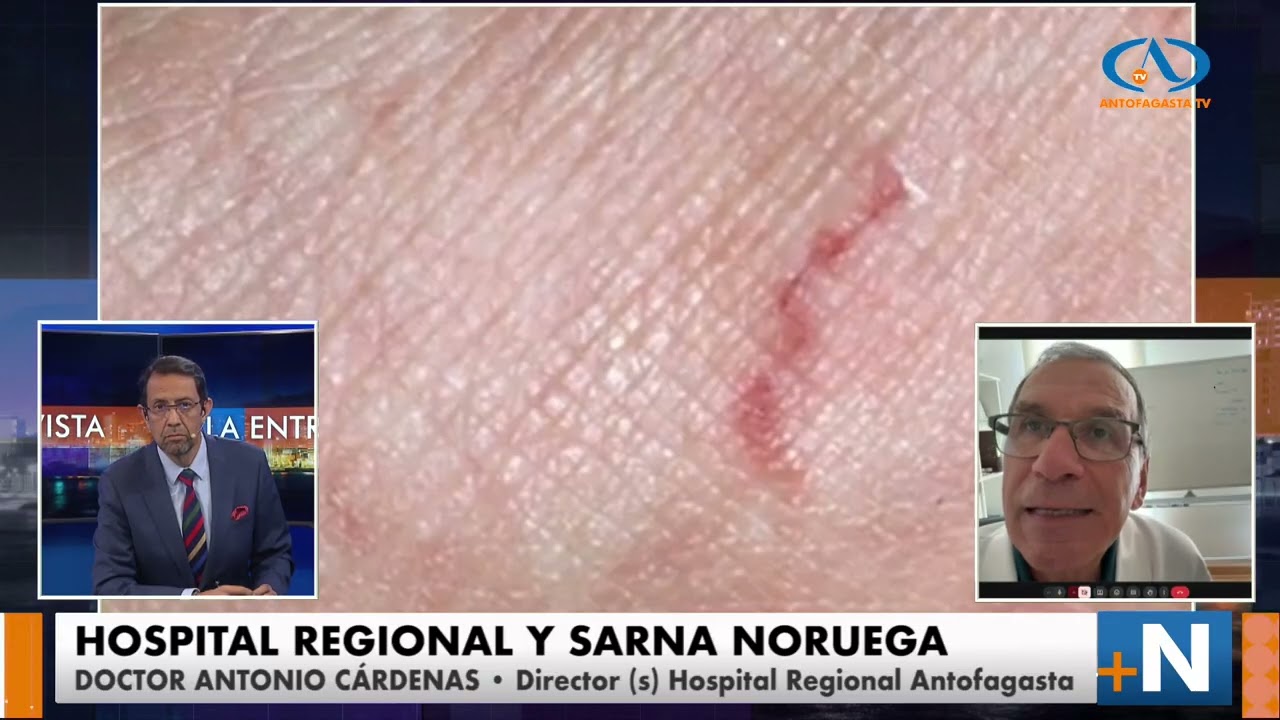 Entrevista al Doctor Antonio Cárdenas, Director (s) Hospital Regional de Antofagasta