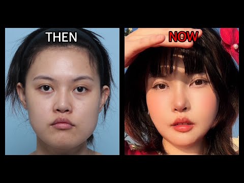 Results That Satisfy: An Influencer's Post-Surgery Transformation