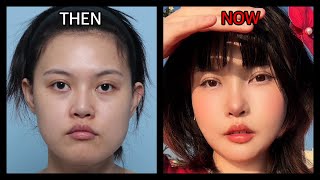 Results That Satisfy: An Influencer's Post-Surgery Transformation