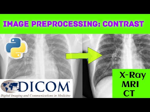 Preprocessing: How to enhance the contrast of DICOM standard images ...