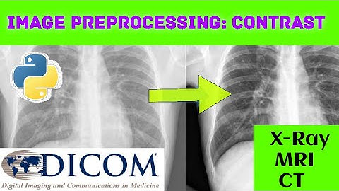 Preprocessing: How to enhance the contrast of DICOM standard images | Python Programming|