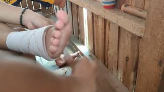 HOW TO WRAP A CREPE BANDAGE ON ANKLE