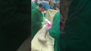 first OT in 3rd year. #sho#medical #surgery #surgeon #doctor #trend #like #subscribe