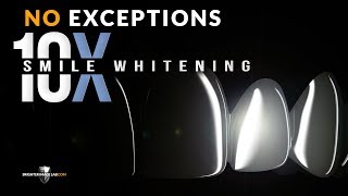 How To Whiten Your Teeth at Home! Extremely White! No Exceptions! How To Whiten Your Teeth at Home! Extremely White! No Exceptions!