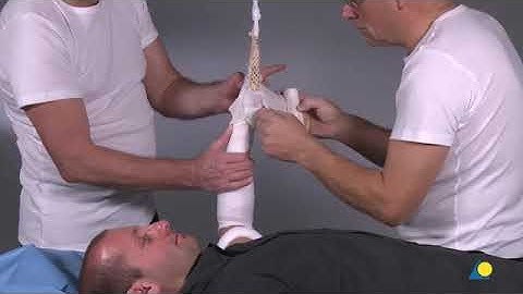 Colles Fracture Reduction and Cast Application (short arm cast)