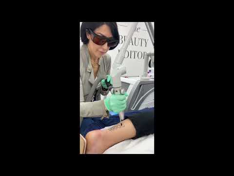 What can you treat with laser?