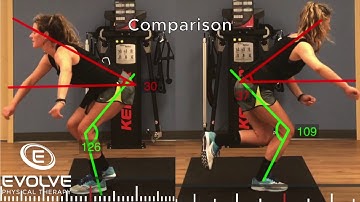 Anterior Cruciate Ligament Reconstruction | Power Testing for Return to Play
