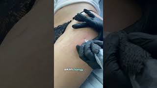 Inkless Stretch Mark Treatment Worth The Hype?! #stretchmarksremoval #stretchmarks #skin #pmuartist