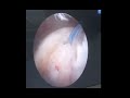 surgery