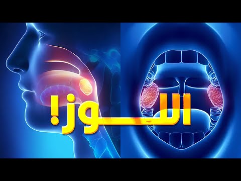إيه هي اللوز وليه بنشيلها