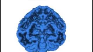 Real-Time Ray Traced Iso Surface Bouncing Brain