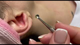 Ear cleaning. تنظيف الأذن. كيف ينظف خبير التجميل الاذن؟