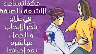 هكذا تساعد الأشعة بالصّبغة على الحمل مباشرة بعد إجرائها.. وهذه فرص الحصول على الحمل