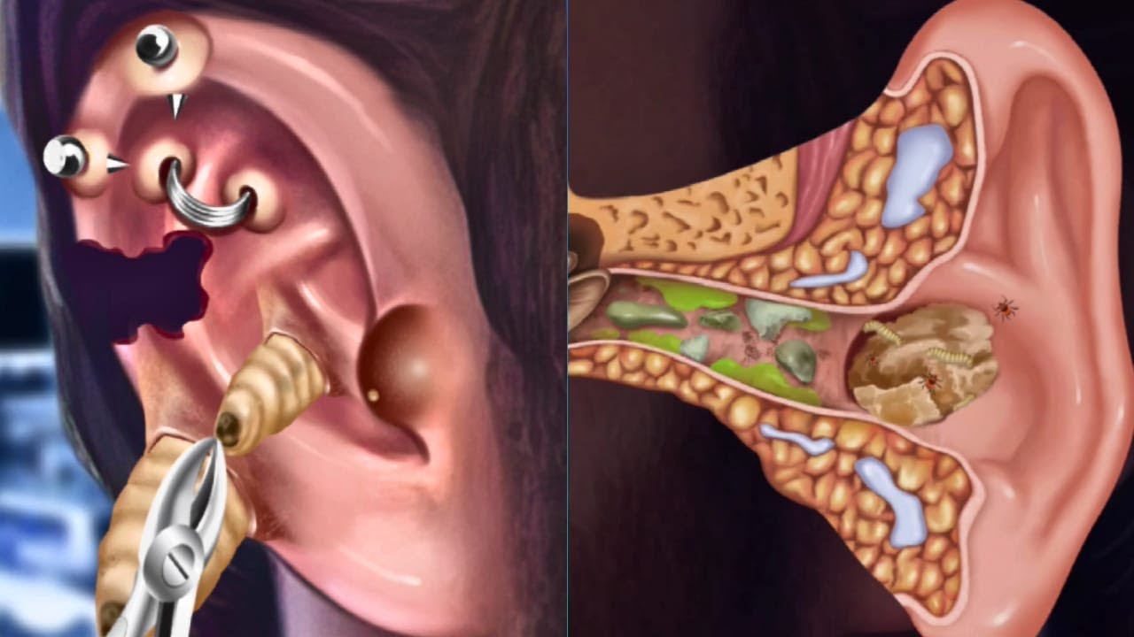 ASMR Removing Ear Piercing Jewelry and All the Dirt from Inside to